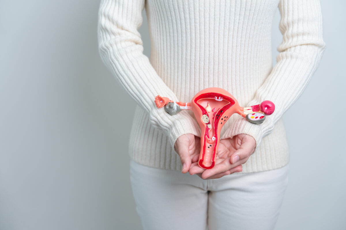 What is PCOS
